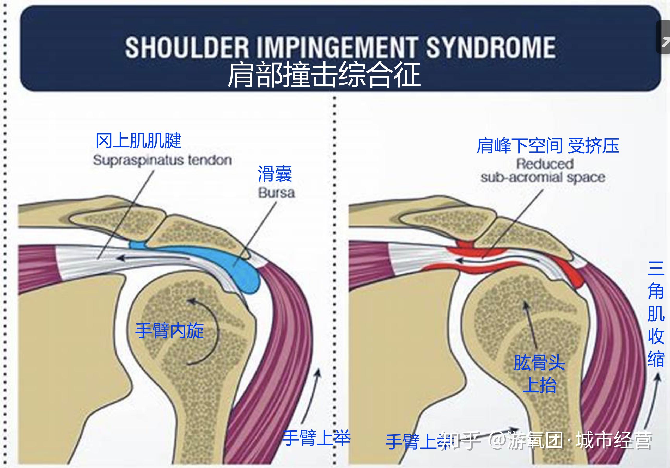肩部结构及收缩功能 - 知乎