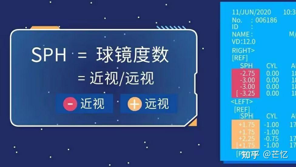 #看懂电脑单和验光单# - 知乎