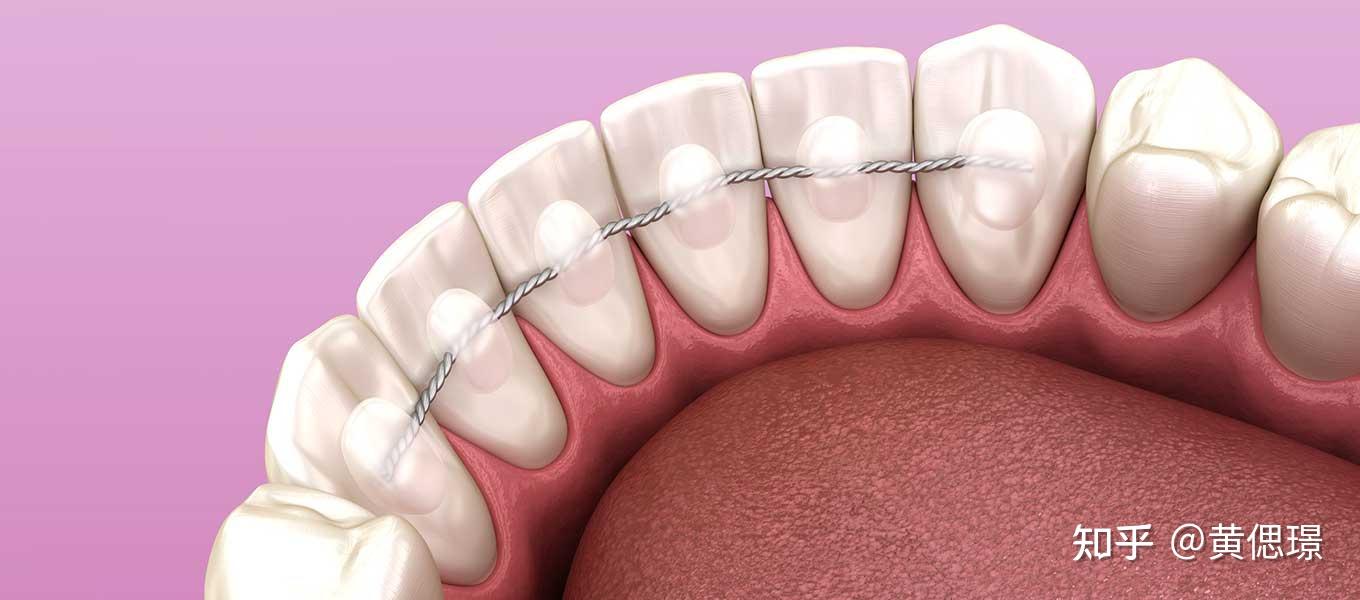 戴塑料透明保持器蛀牙越来越多怎么办