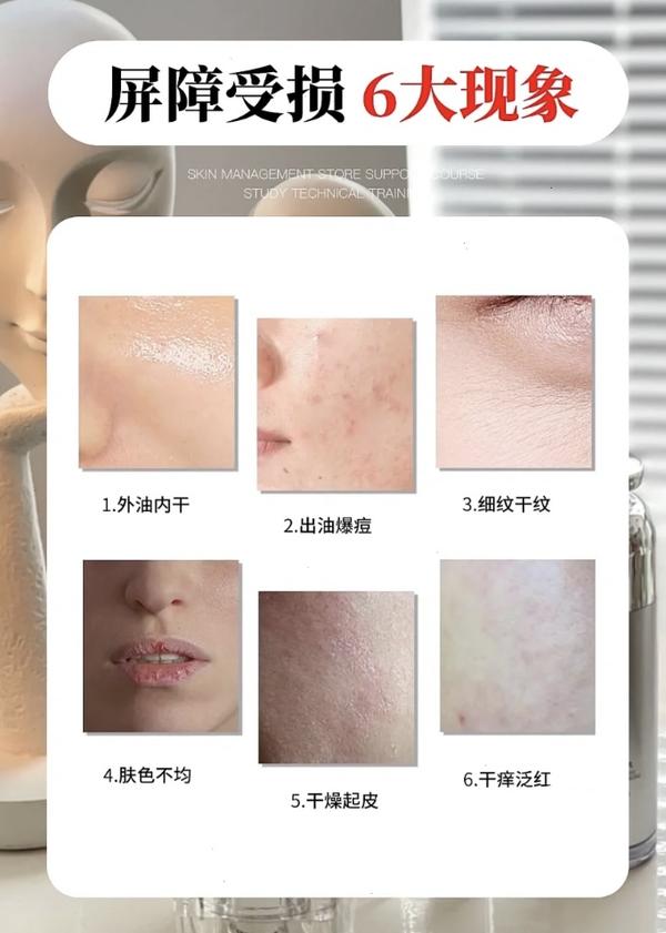 孕妇该如何护肤保养_护肤保养步骤_孕妇护肤保养