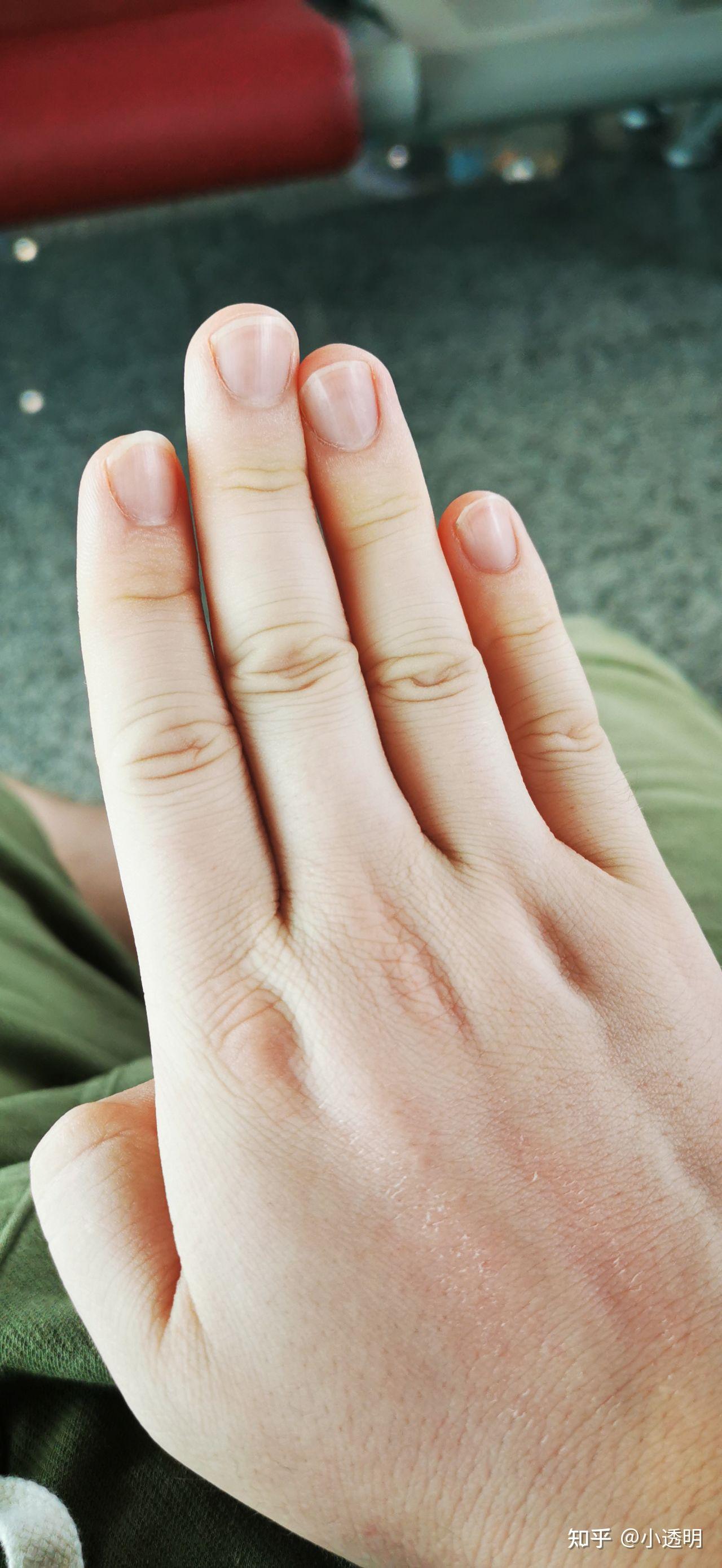 怎样让手指变得纤细,骨感和修长呢? - 知乎