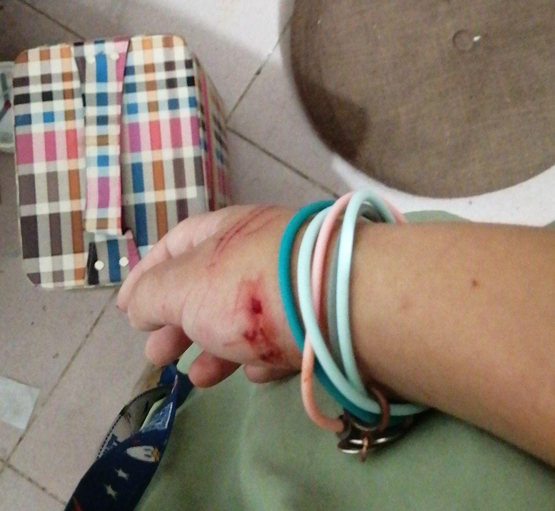 被兔子抓伤会得狂犬病吗?需要看医生吗? - 知乎