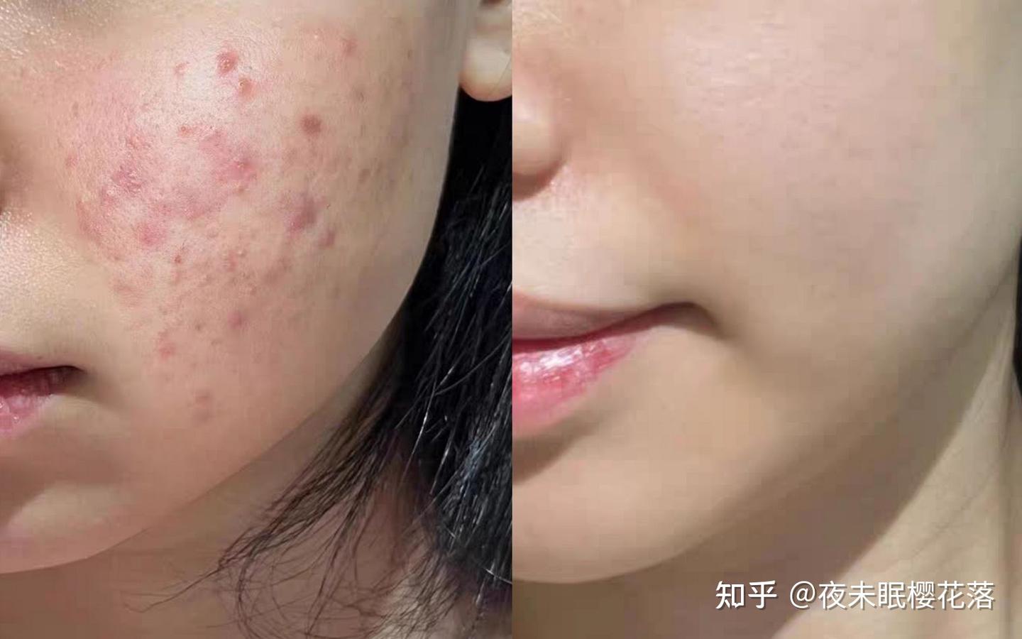 海蓝之谜洗面奶125ml测评：我用它解锁了3个「人生场景」，油敏皮终于得救了！ - 知乎