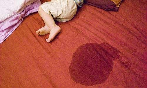 小孩尿床尿裤子原因有哪些怎么解决呢