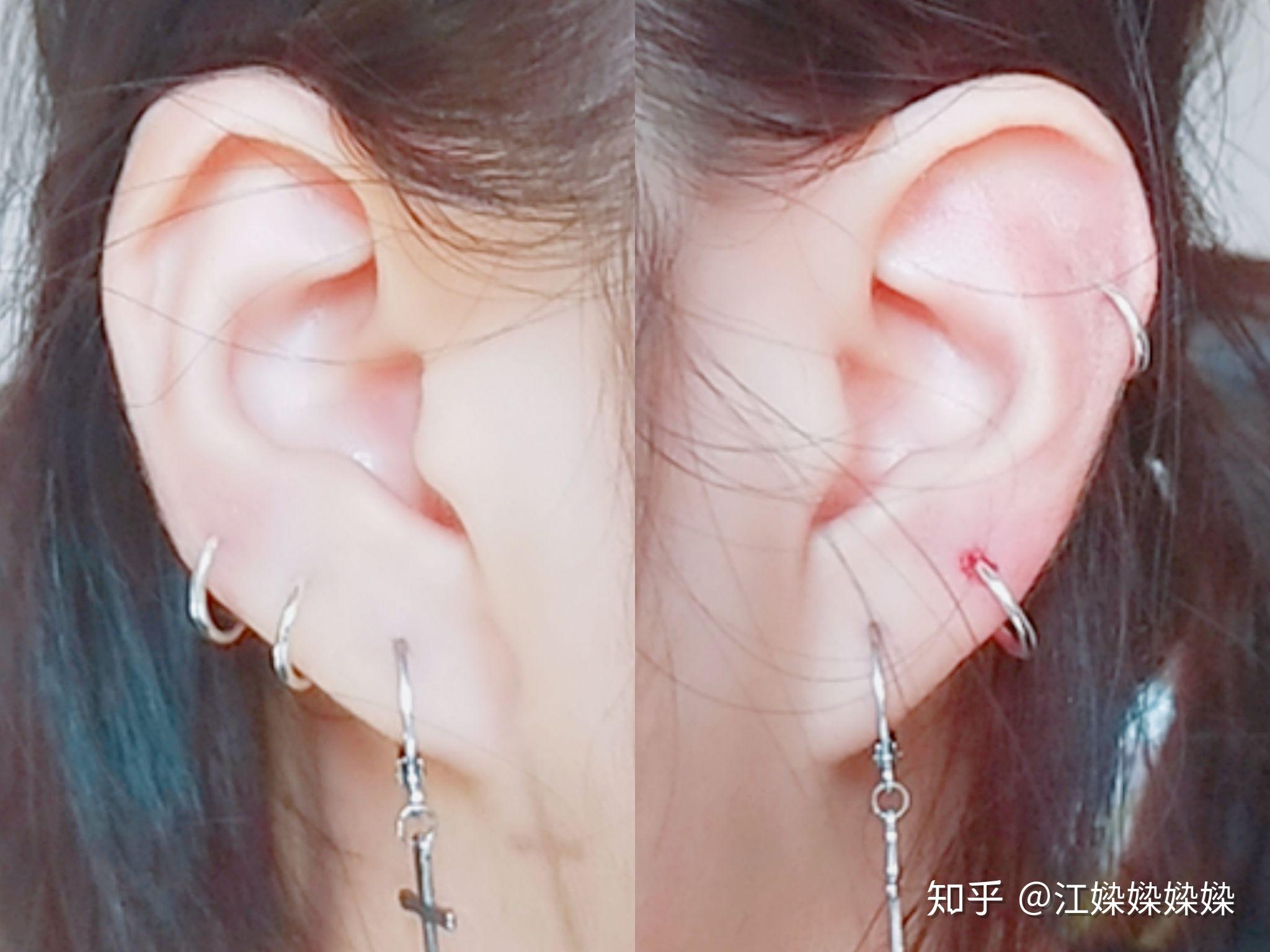 女生打两个及以上耳洞是什么体验