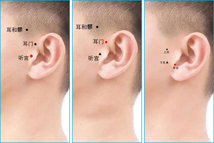 记住这几个穴位,这样艾灸有效缓解耳鸣耳聋 知乎