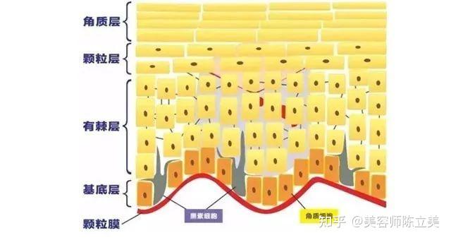景博士祛斑皮膚角質層為什麼會薄怎麼保養才好
