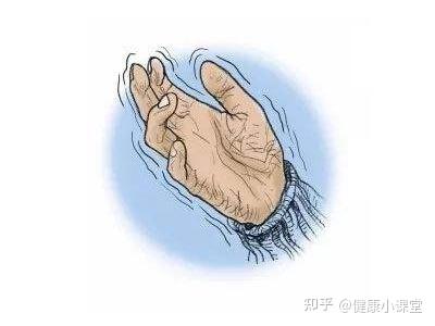 你真的了解手抖吗? - 知乎