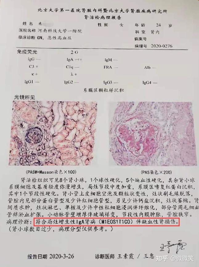 iga肾病肌酐从158降到109提示这一类肾友可逆转肾功能
