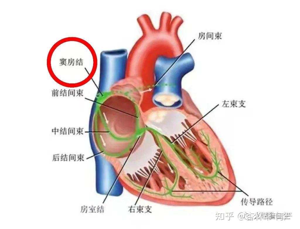 胶囊大小的心脏起搏器,您见过吗?