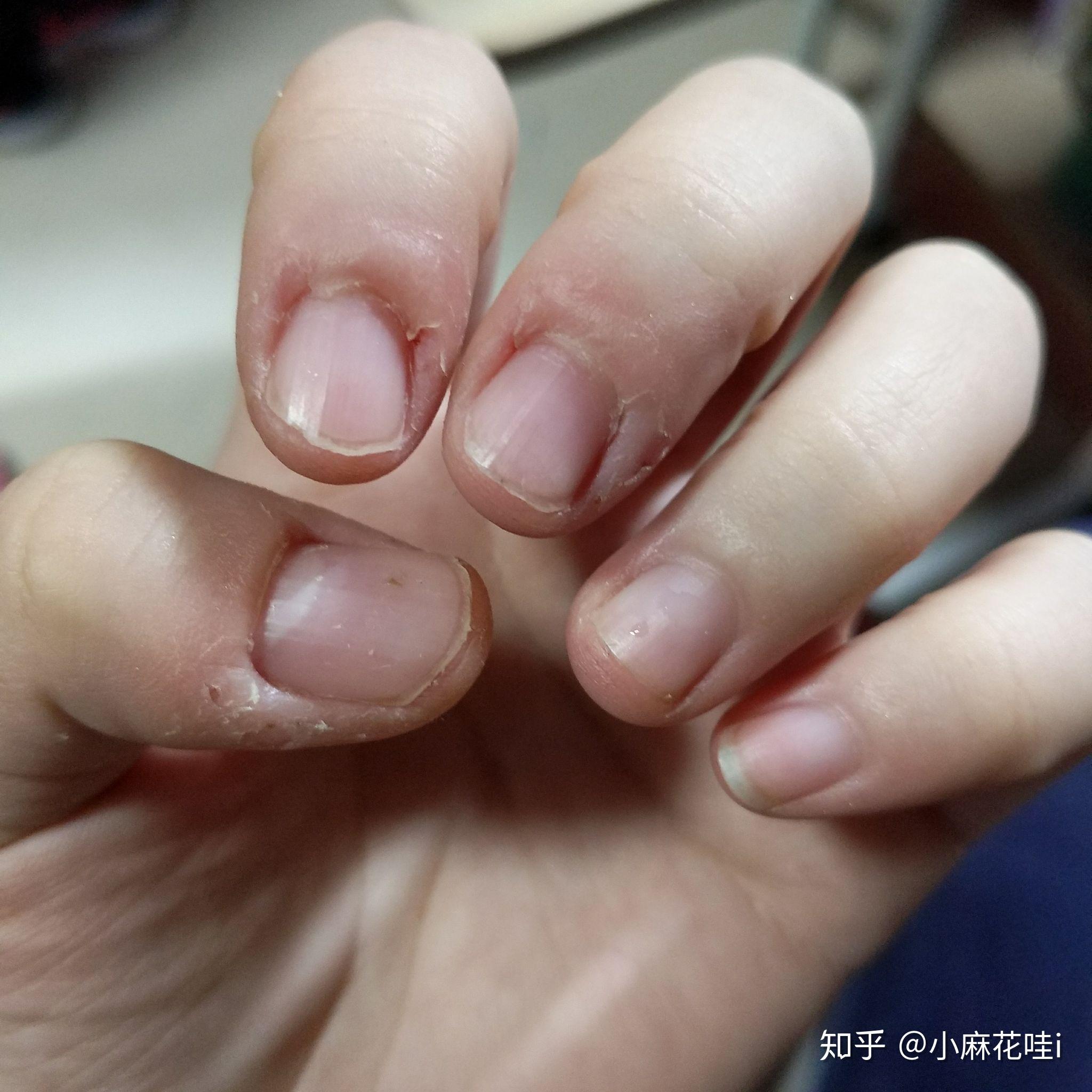 成年人如何改掉抠手的习惯有什么心理学道理