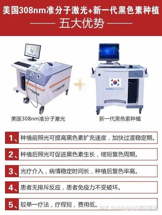 汕頭中科白癜風醫院美國308nm準分子激光了解一下