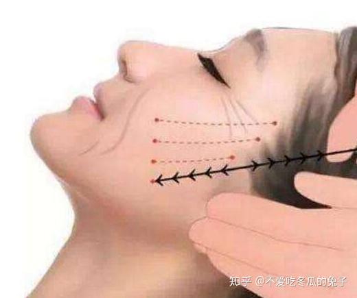 30岁做线雕疼吗小白告诉你做线雕后要注意些什么别小看