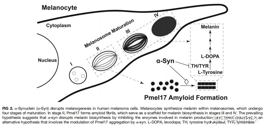 帕金森氏病和黑色素瘤的联系α突触核蛋白与pmel17形成之间的相互作用