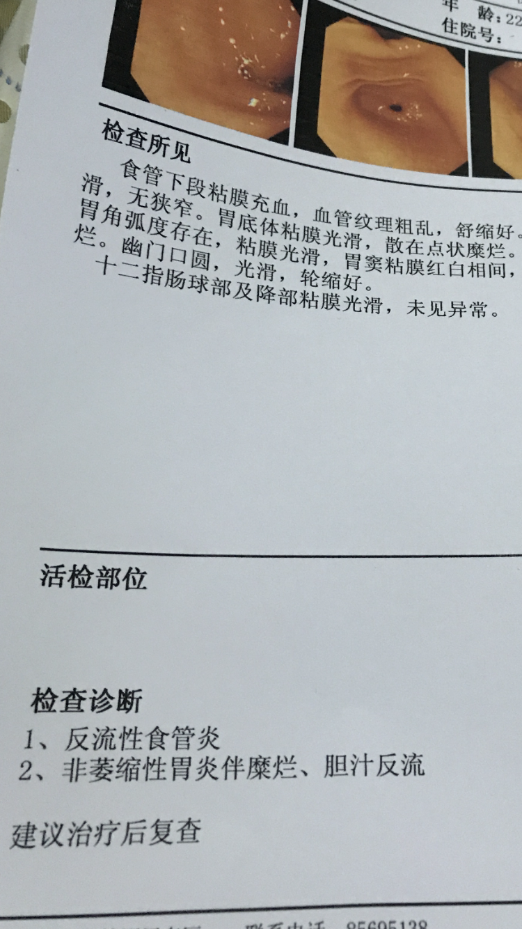 十二指肠球部多发溃疡a1期慢性浅表性胃炎伴糜烂hp有什么专业系统的