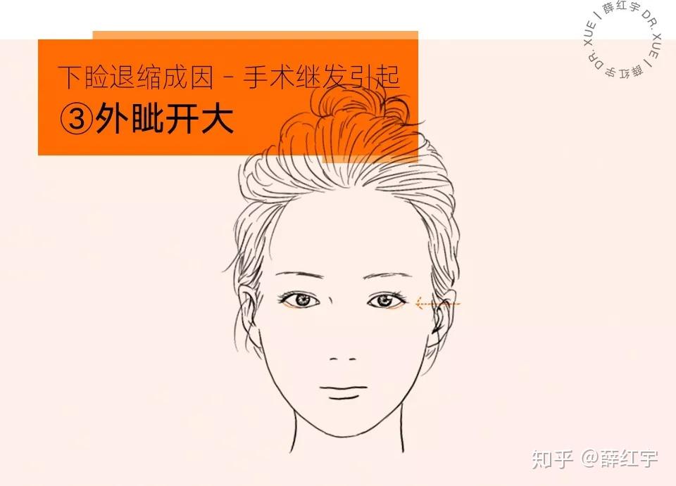 三白眼怎么办? - 知乎