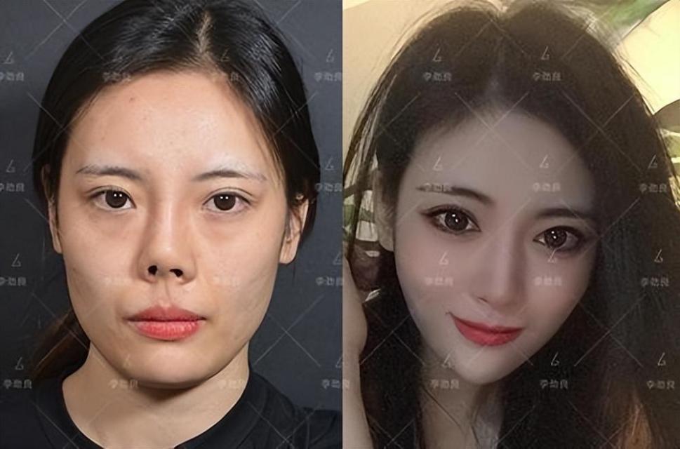 49岁牛莉整容失败,鼻子“牛气冲天”,网友称“毁容式变脸”! - 知乎