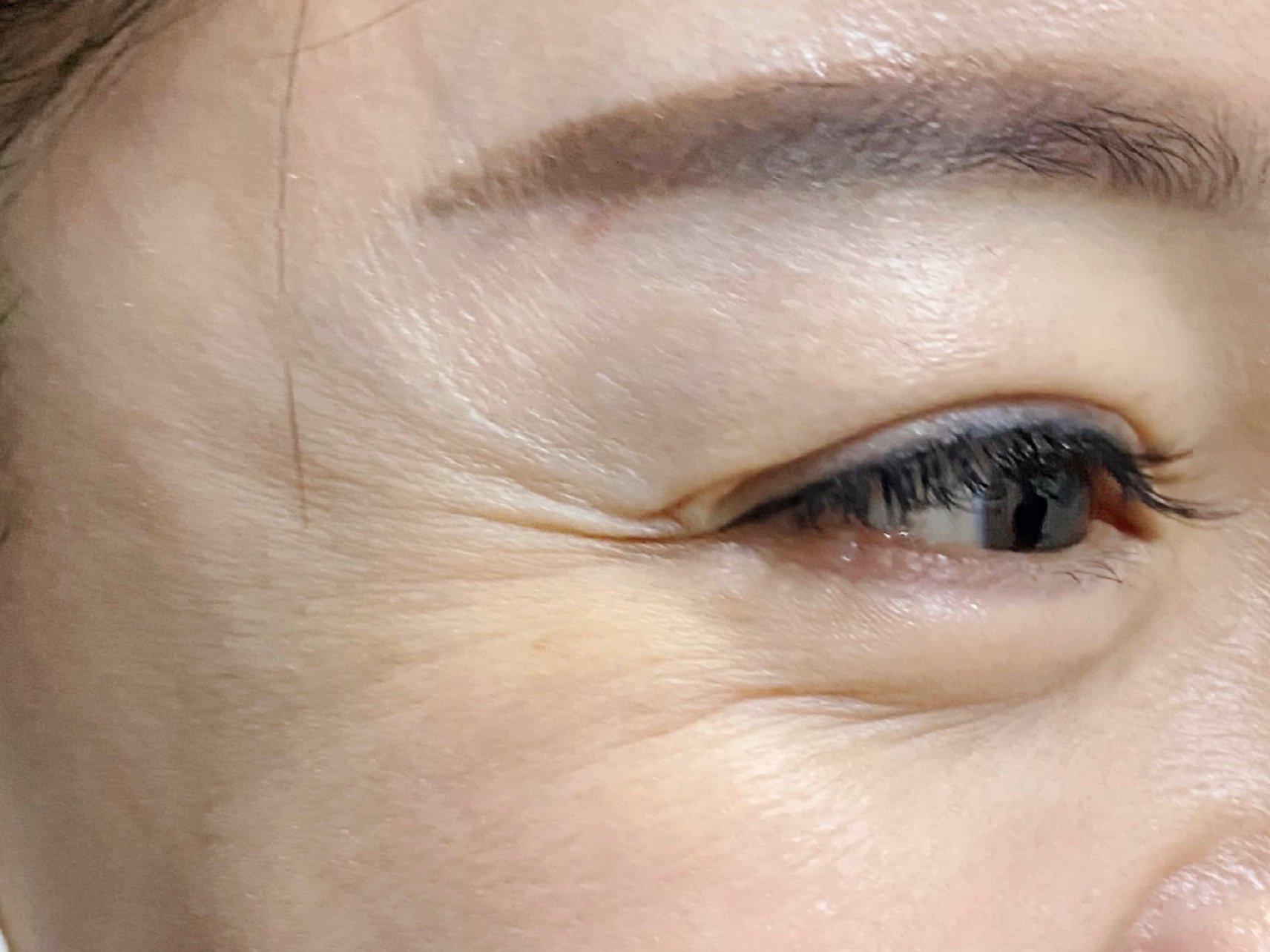 4 岁儿子指着我的鱼尾纹问「妈妈,你的脸上是不是被刀划了?