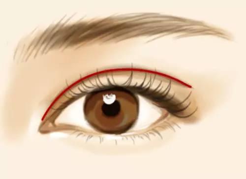 双眼皮比较受时尚女孩的喜爱,双眼皮形态内窄外宽,越向外眦双眼皮越宽