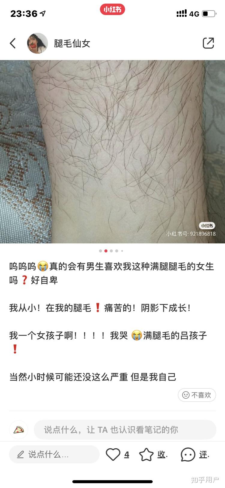 男生看到有腿毛的女生是什么感受? - 知乎
