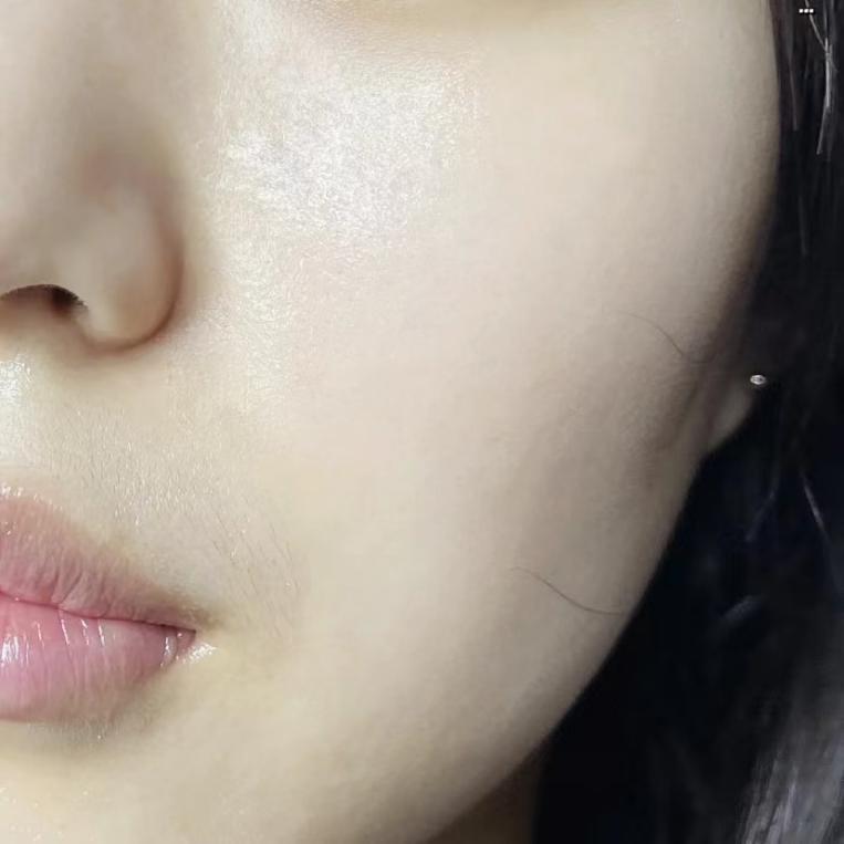 脸出油很厉害该怎么办