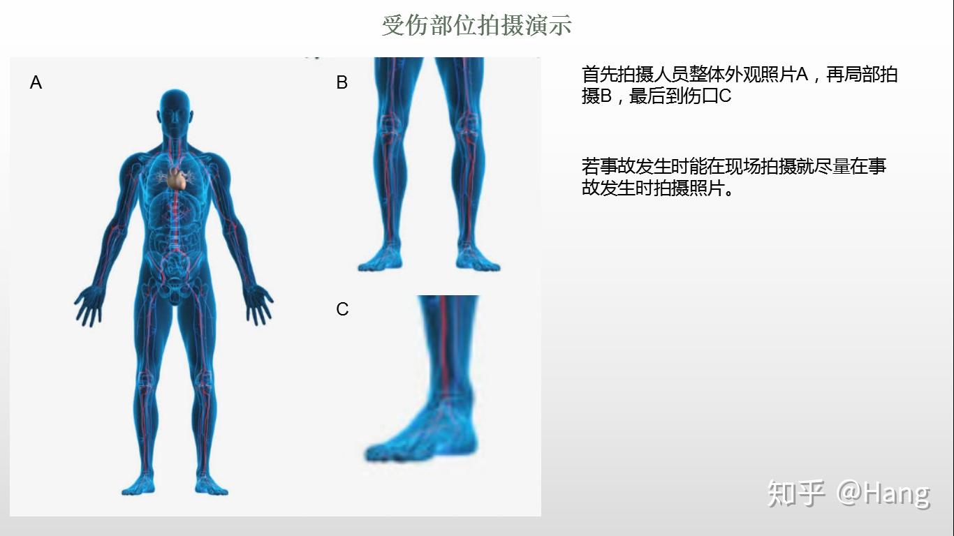 3.受伤部位照片众包骑手app订单截图雇主骑手订单截图2.