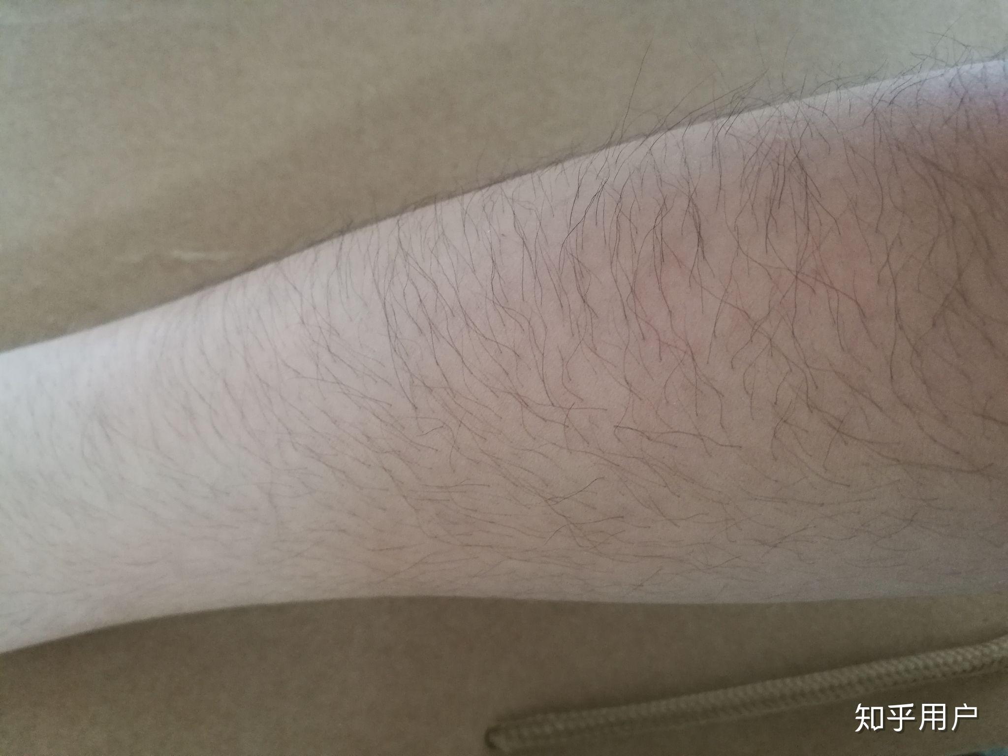 女生长浓密手毛是一种什么样的体验?