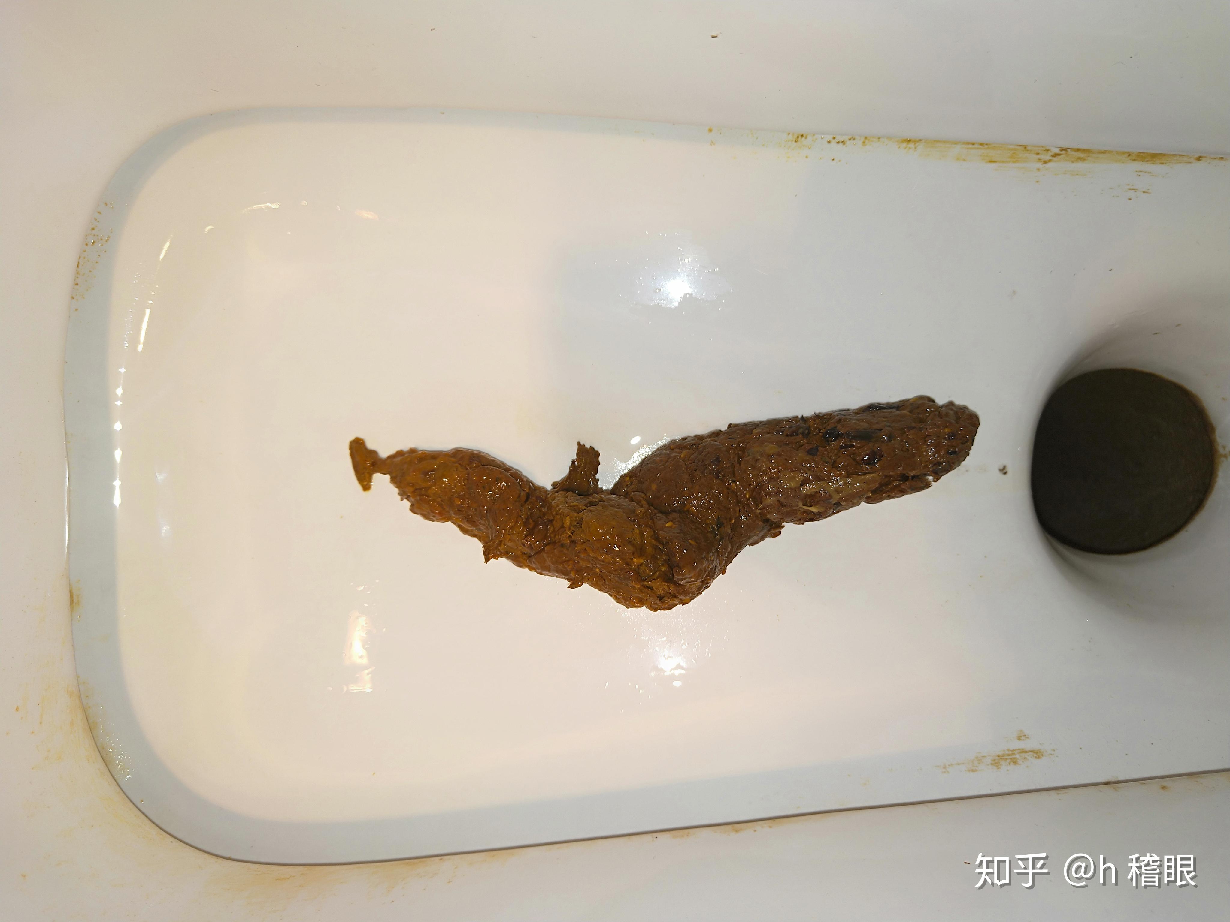 差点被一泡屎憋死是什么体验? - 知乎