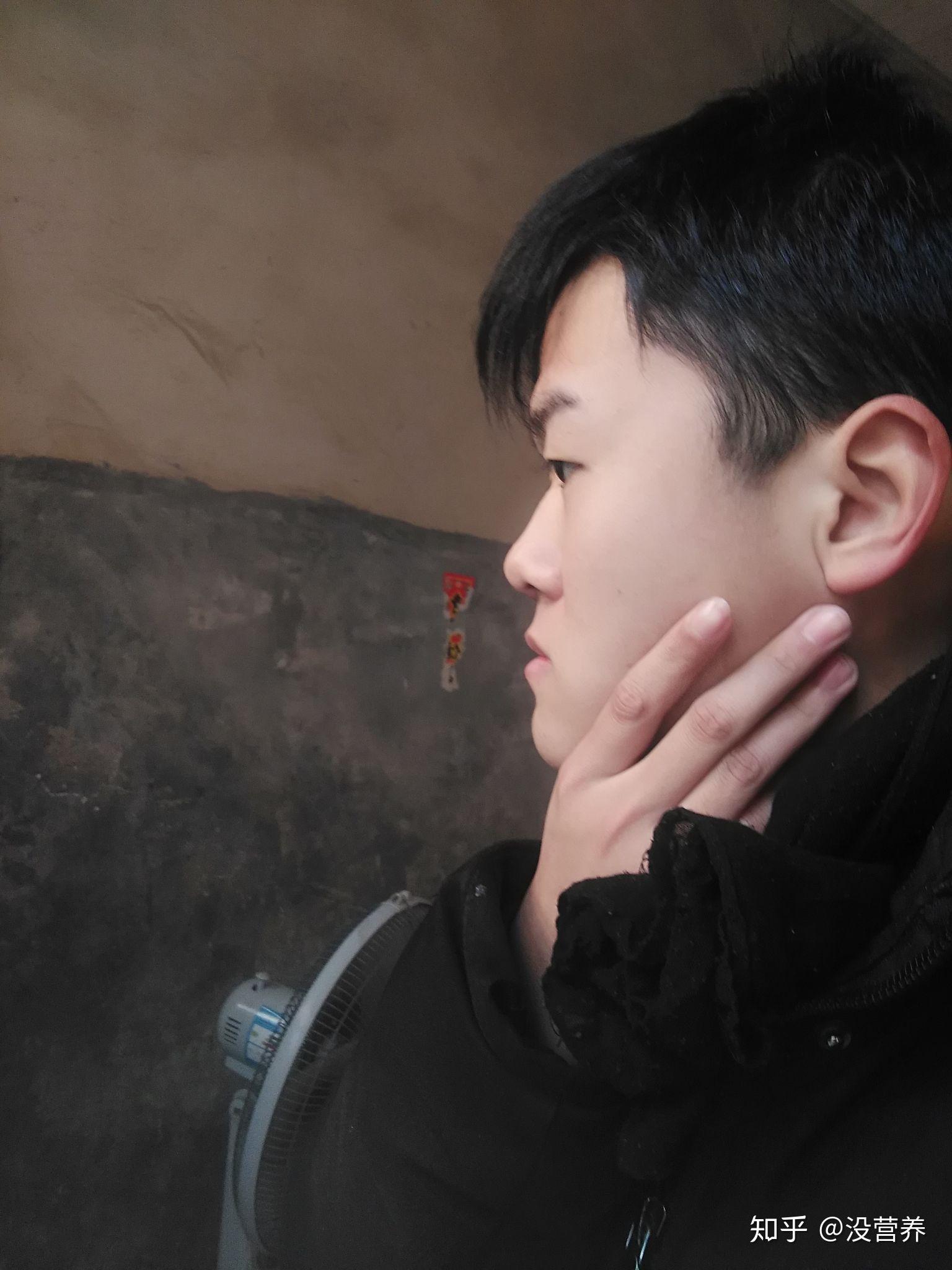 侧脸地包天(芒果脸,月亮脸,鞋拔子脸)是怎样的一种体验? - 知乎