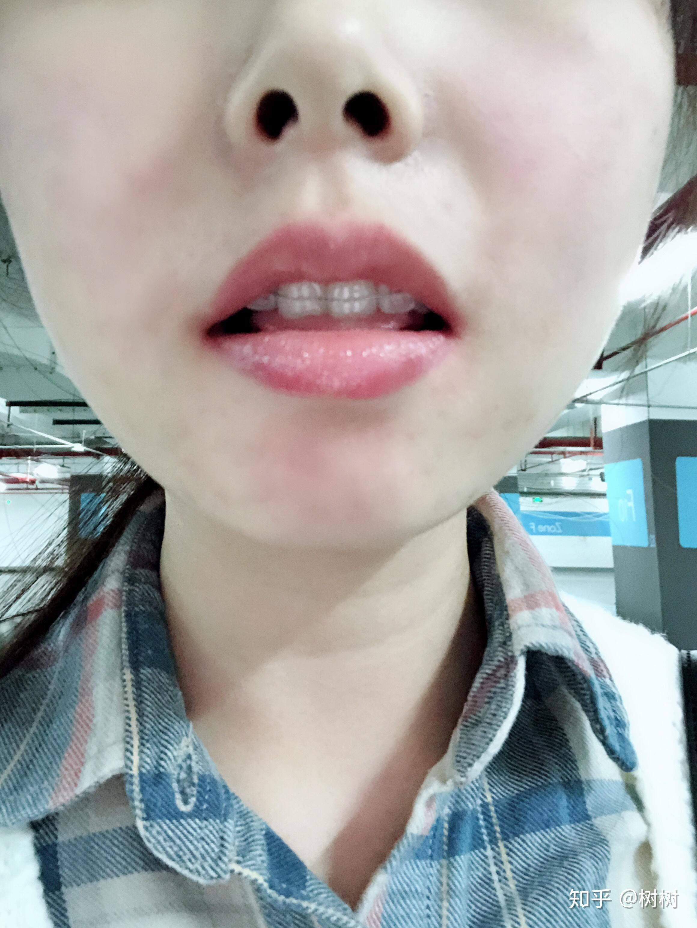 v2-3610ab53c48bea6af54f563a676ca1c0_r.jpg