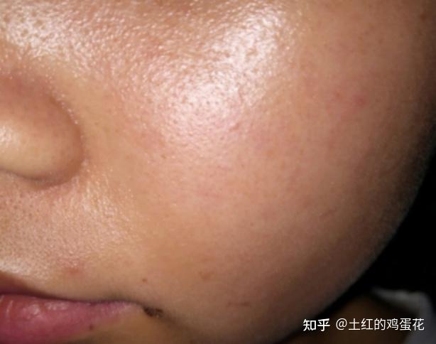 请求大数据把我推给熬夜脸暗黄油的姐妹!