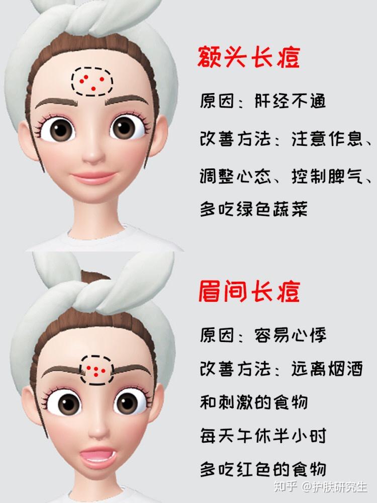 最好的祛痘方法是什么?