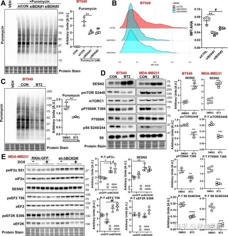 看懂此文7分cdd随意发乳腺癌阿霉素关键基因影响线粒体增敏机制