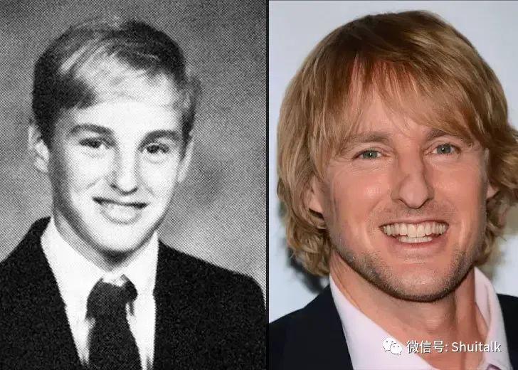 八卦:欧文·威尔逊 owen wilson 的鼻子 