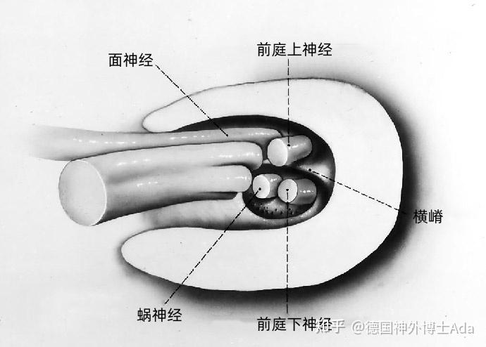 听神经瘤解剖---Rhoton解剖文献学习笔记系列 - 知乎