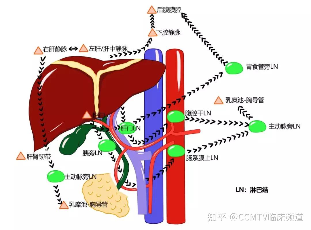 门静脉周围的淋巴网络通常与门静脉,肝动脉和胆管一起走形在格林森鞘