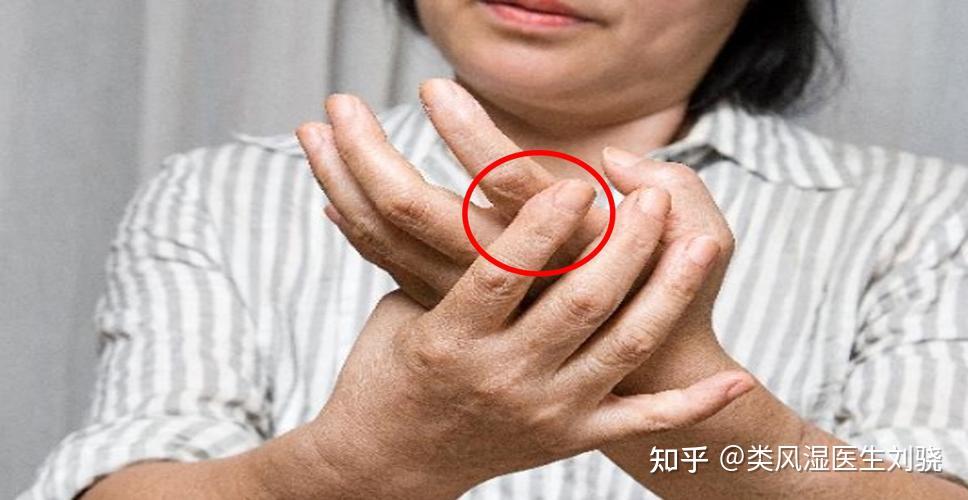 手抖的原因手颤抖是怎么引起的？ - 知乎