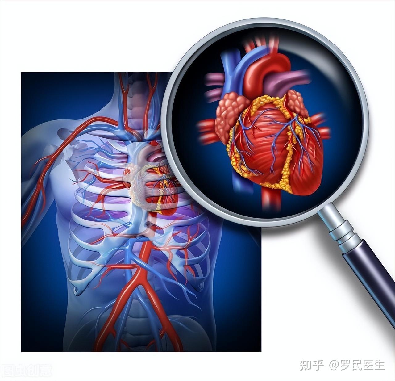 冠心病患者人数逐年上升,如何进行自我诊断?如何治疗?