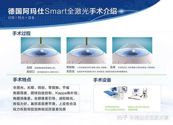 干货 如何正确选择近视手术方式 知乎