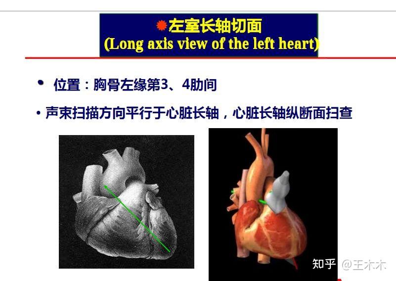 心脏短轴图片