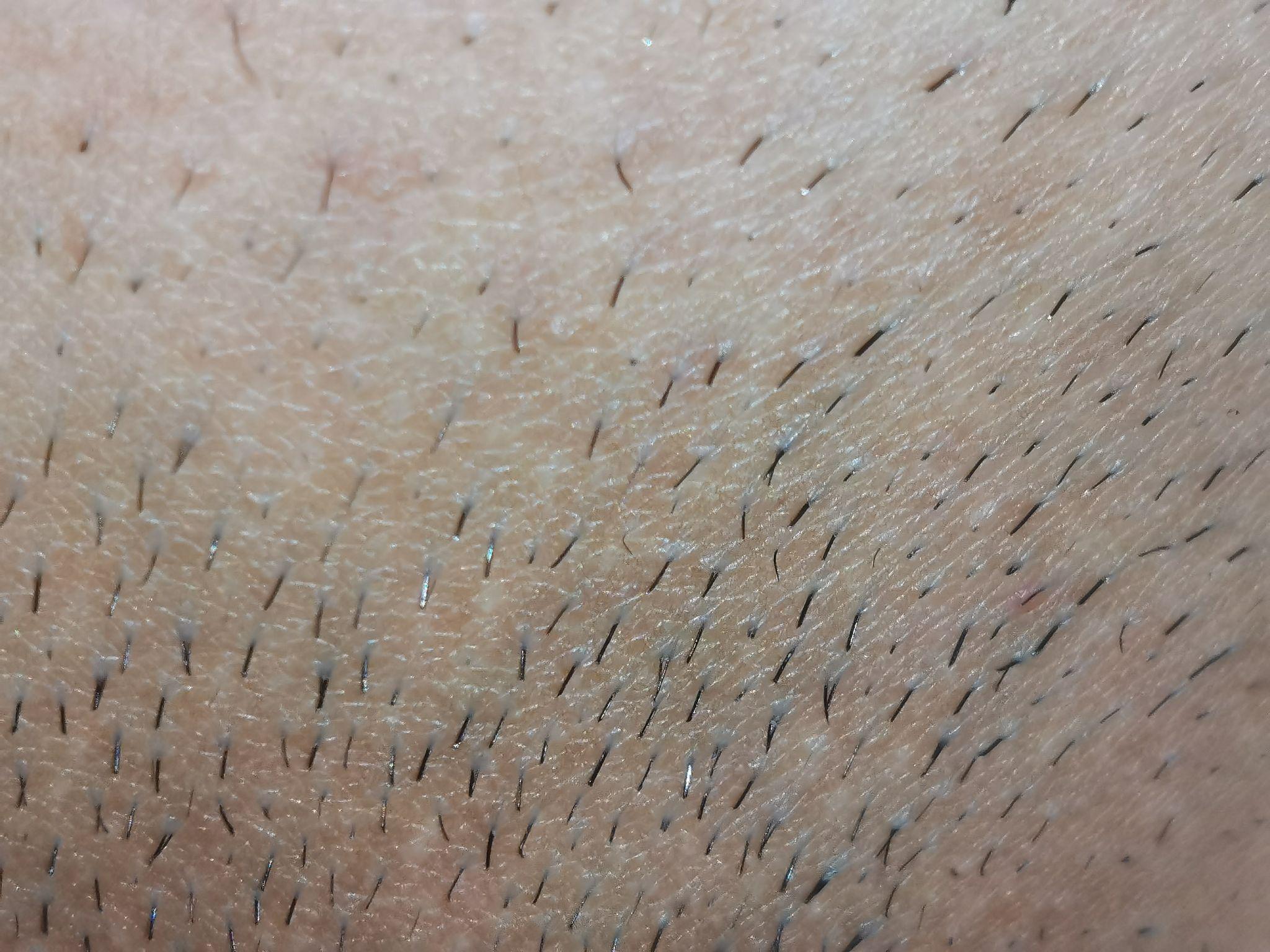 脱阴毛的男生是什么感觉? - 知乎