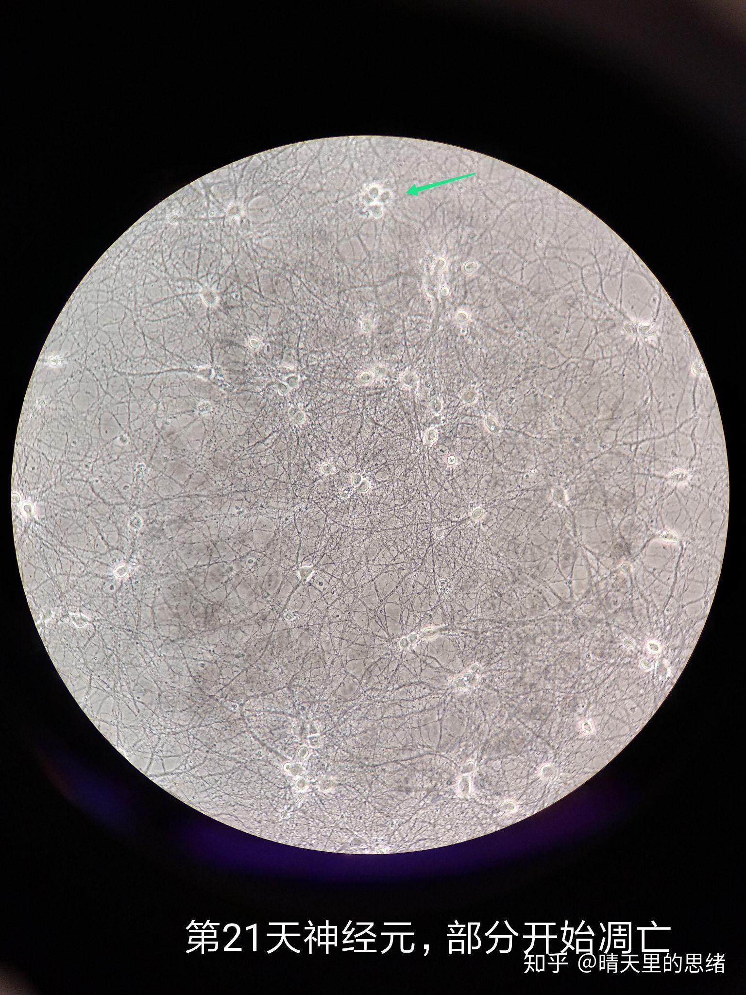 sd大鼠海马神经元原代细胞培养