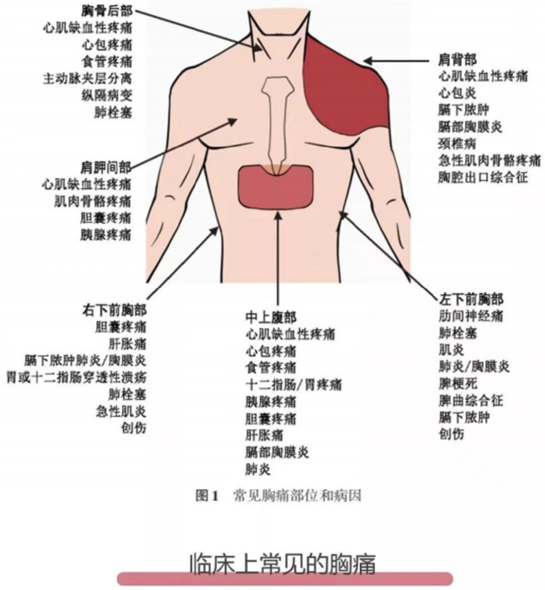 心梗背部疼痛位置图图片