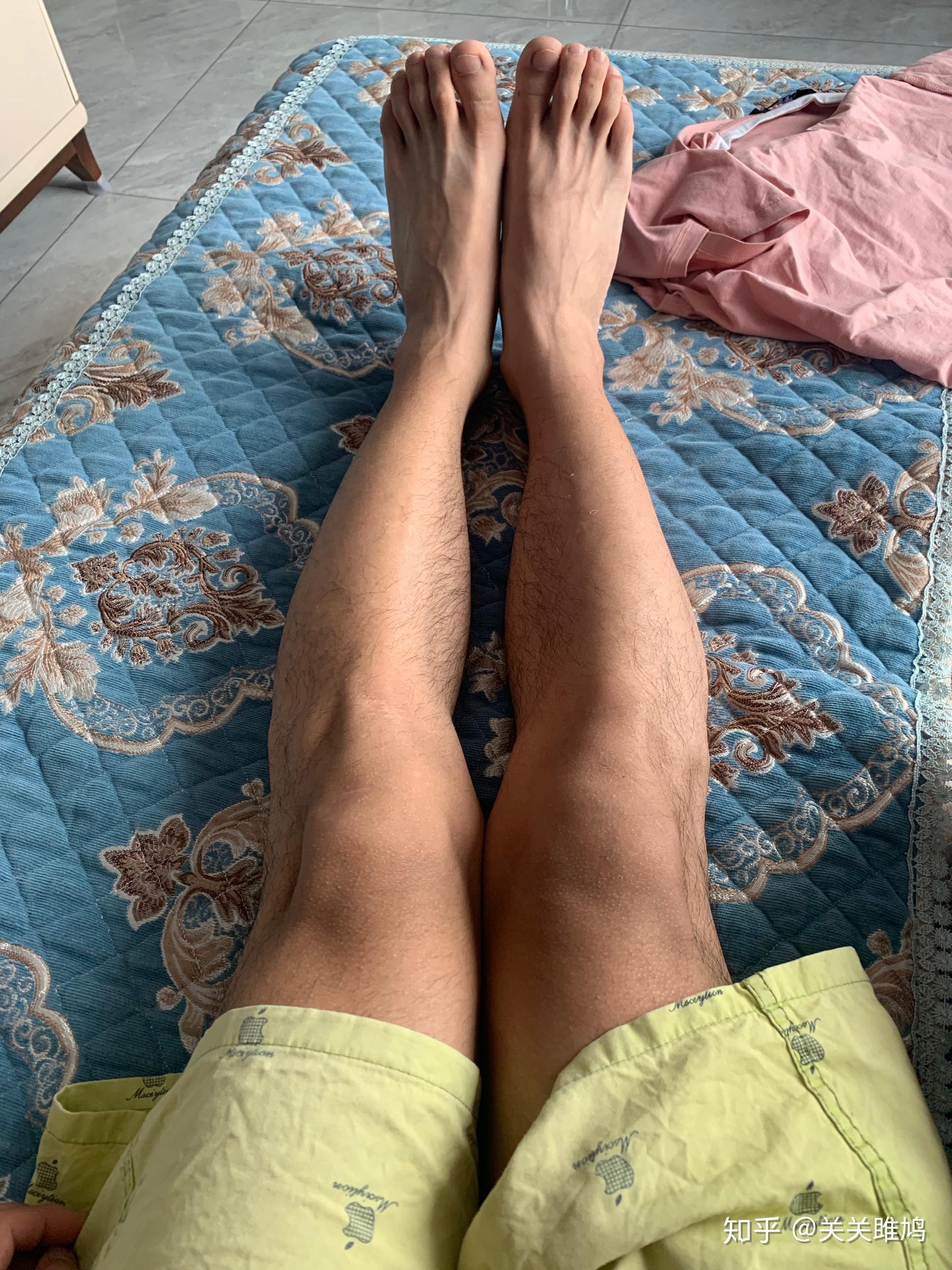 这样的腿型是畸形吗