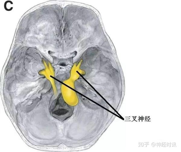 体表神经解剖:三叉神经详解 - 知乎