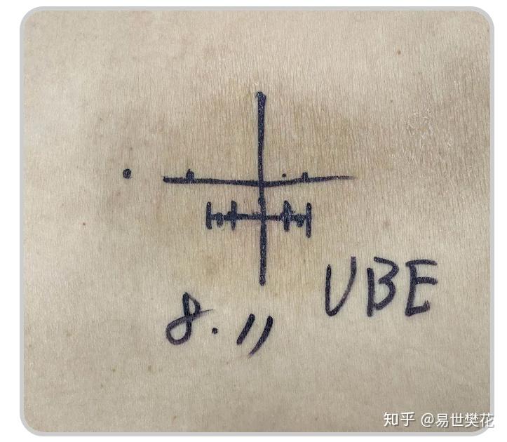 手术切口专家介绍管廷进淄博市第一医院骨二科(脊柱外科脊柱微创中心)