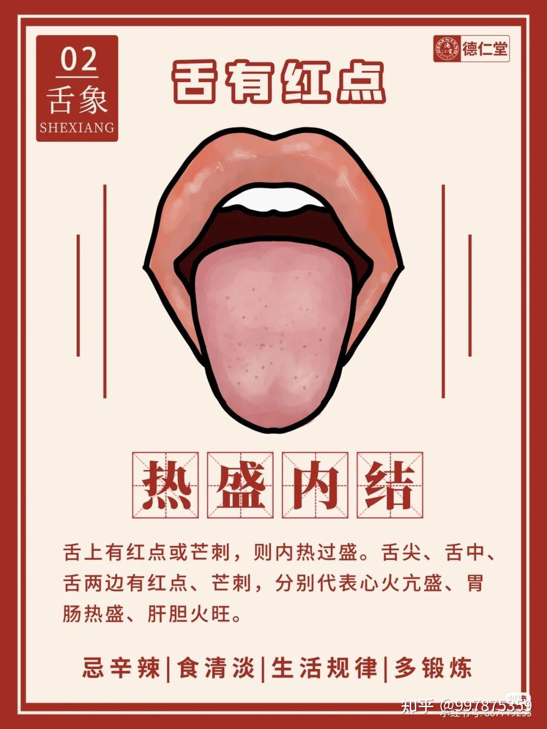 6种中医常见舌象 - 知乎