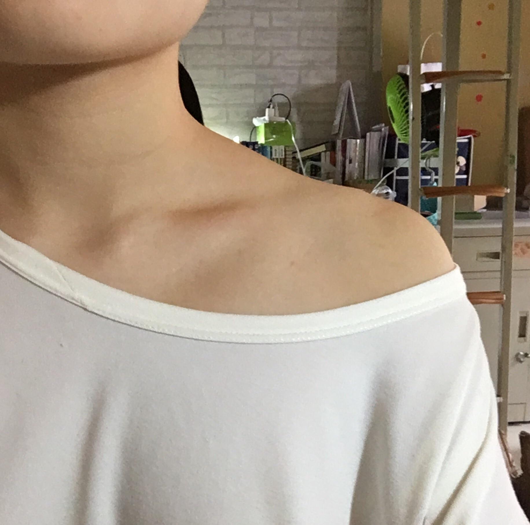 女生肩膀的上斜方肌太粗壮了怎么办? - 知乎