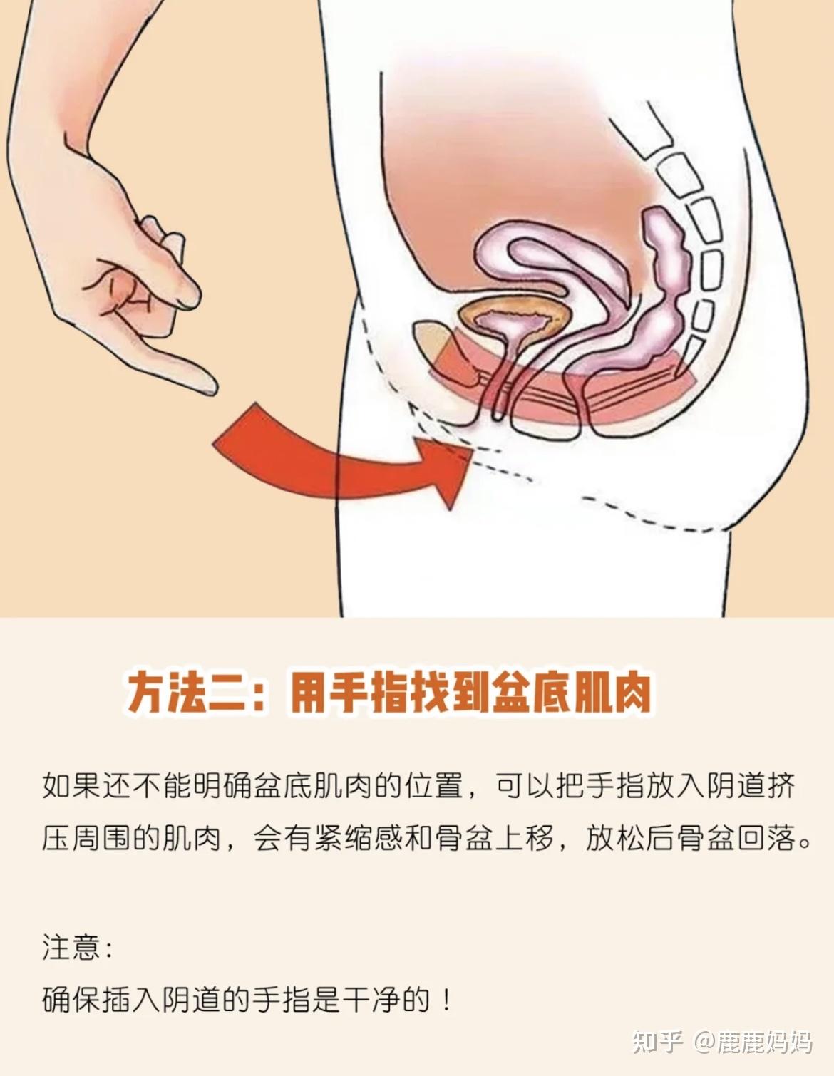 凯格尔盆底肌训练方法图片