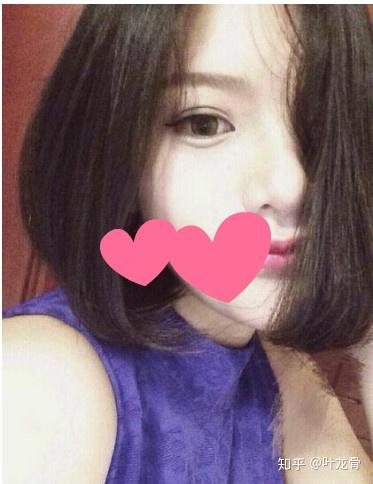 四川自贡有哪些整形医院啊割双眼皮哪家好一点